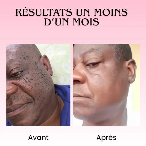 Florelle Anti Verrues