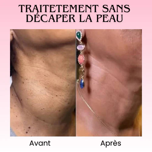 Florelle Anti Verrues