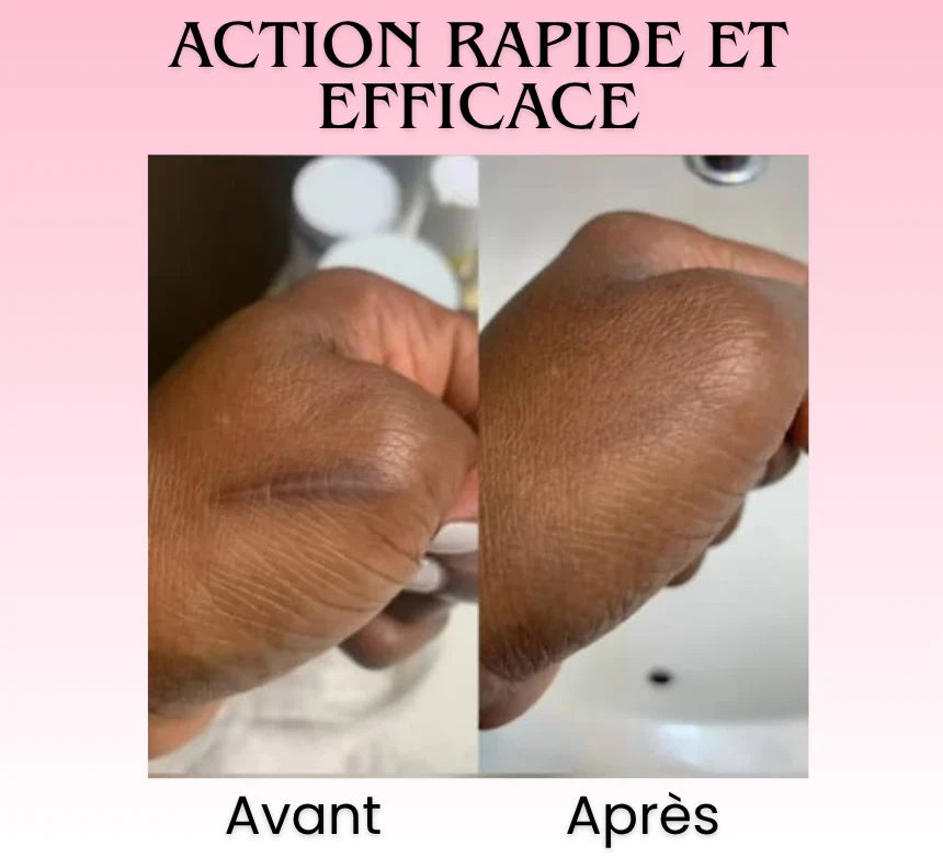 Florelle Anti cicatrices