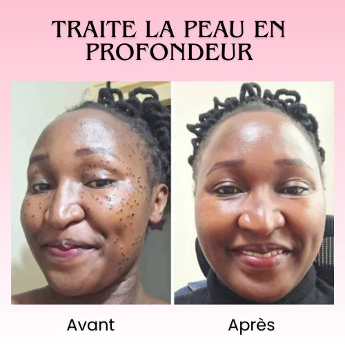 Florelle Anti Verrues