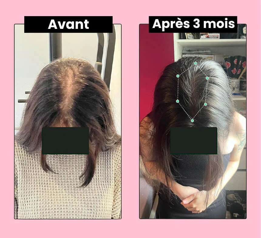 Florelle Repousse Extrême